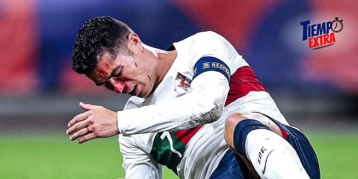 Durísima lesión ensangrentada sufrió Cristiano Ronaldo (+VÍDEO)